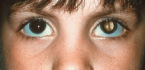 dấu hiệu ung thư mắt ở trẻ