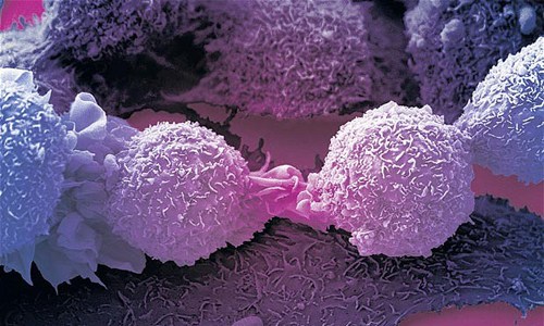Hình ảnh tế bào ung thư