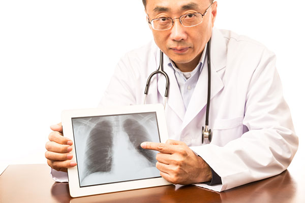 Ung thư phổi - nguyên nhân gây tử vong hàng đầu các bệnh ung thư