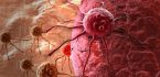Điều trị ung thư phổi hiệu quả với liệu pháp miễn dịch