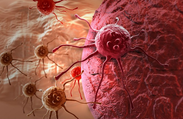 Điều trị ung thư phổi hiệu quả với liệu pháp miễn dịch