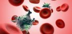 Những lưu ý về ghép tế bào gốc trong điều trị ung thư máu