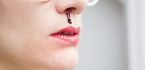 Ung thư vòm họng – nguyên nhân, triệu chứng và cách điều trị