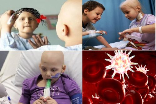 Điều trị ung thư máu ở trẻ em